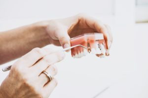 Dental Implants | Bessey Creek Dental Care